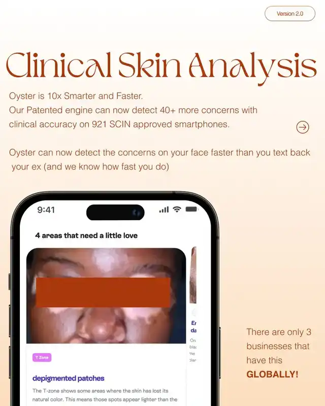 How Oyster reads clinical skin concerns